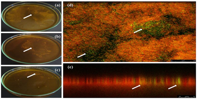 Formazione di biofilm da campioni positivi per A. pleuropneumoniae dall&#39;acqua potabile. (a&ndash;c) Biofilm nell&#39;interfaccia liquido-aria formati in vitro dall&#39;acqua potabile di una fattoria messicana in tre diversi campioni (le frecce mostrano i biofilm). (d,e) tecnica FISH per rilevare A. pleuropneumoniae in biofilm da campioni di acqua potabile da allevamenti di suini; A. pleuropneumoniae &egrave; stato rilevato con sonde etichettate con fluoresceina (verde) e altri batteri sono stati etichettati con bromuro di etidio (rosso) (le frecce mostrano l&#39;etichetta di A. pleuropneumoniae). (a,d,e) Ags5-I, (b) Ags5-II e (c) Ags5-III.
