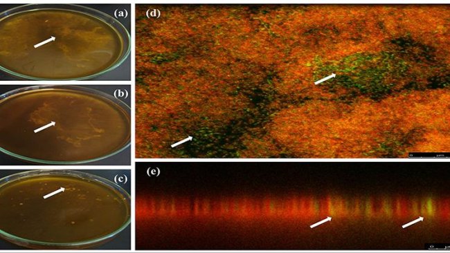 Formazione di biofilm da campioni positivi per A. pleuropneumoniae dall'acqua potabile. (a–c) Biofilm nell'interfaccia liquido-aria formati in vitro dall'acqua potabile di una fattoria messicana in tre diversi campioni (le frecce mostrano i biofilm). (d,e) tecnica FISH per rilevare A. pleuropneumoniae in biofilm da campioni di acqua potabile da allevamenti di suini; A. pleuropneumoniae è stato rilevato con sonde etichettate con fluoresceina (verde) e altri batteri sono stati etichettati con bromuro di etidio (rosso) (le frecce mostrano l'etichetta di A. pleuropneumoniae). (a,d,e) Ags5-I, (b) Ags5-II e (c) Ags5-III.