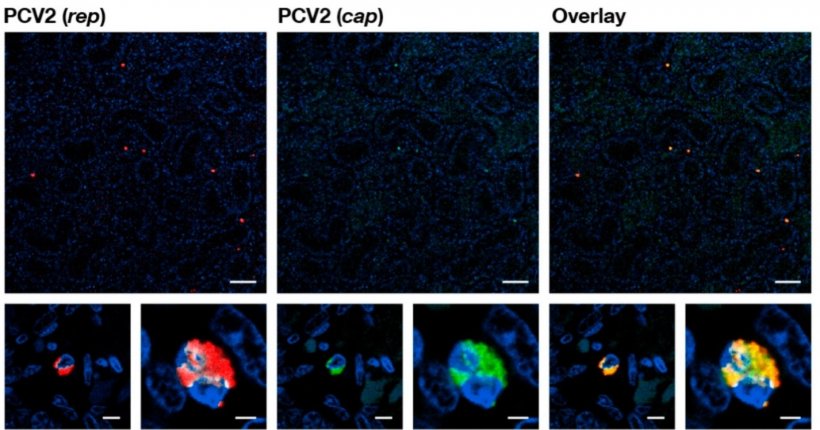 Fig1.Microscopia confocale di un&#39;ibridazione in situ fluorescente (FISH) sezione di tessuto testicolare inclusa in paraffina di un feto nato morto infetto (+++) ad alto PCV2 &quot;latente&quot;. I pannelli mostrano, da sinistra a destra, i segnali di ibridazione fluorescente dell&#39;oligonucleotide PCV2 che riconosce il rappresentante (rosso), l&#39;oligonucleotide per il cappuccio di riconoscimento dell&#39;oligonucleotide PCV2 (verde) e la sovrapposizione dei segnali (giallo). I nuclei (colorati con DAPI) appaiono blu. I pannelli inferiori mostrano due diversi ingrandimenti di due punti diversi nel pannello superiore. La barra bianca indica la lunghezza di riferimento di 50 &mu;m per i pannelli superiori e le lunghezze di riferimento di 5 &mu;m e 2 &mu;m si alternano per i pannelli inferiori.
