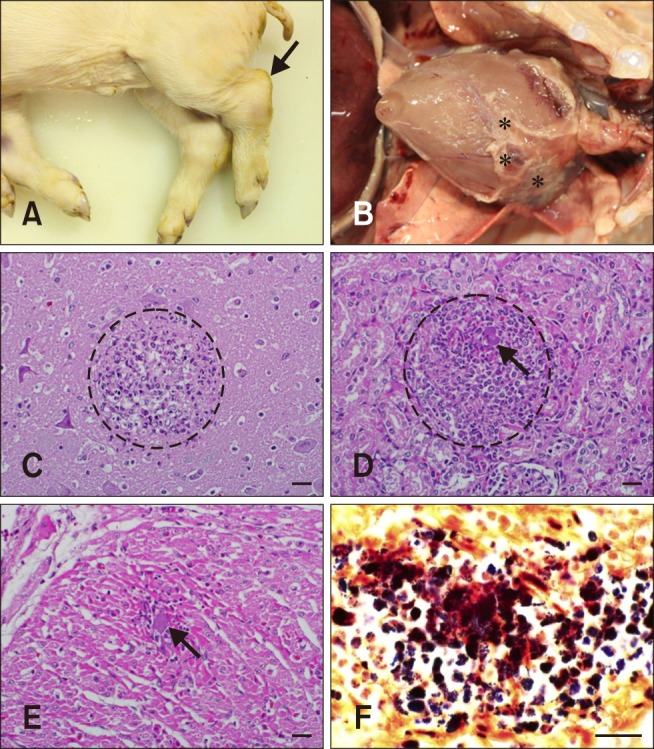 Caso 1. Reperti grossolani e istopatologici. (A) suinetto. Notare l&#39;articolazione tarsale aumentata di volume&nbsp;(freccia). (B) Cavit&agrave; toracica. Materiali giallastri (asterischi) erano attaccati all&#39;epicardio. (C) Cervello. &Egrave; stata osservata encefalite suppurativa con microascessi multifocali (cerchio). Colorazione di ematossilina ed eosina (H&amp;E). 400&times;. (D) Rene. Notare i microascessi multifocali (cerchio) con batteri intralesionali (freccia). Macchia H&amp;E. 400&times;. (E) Cuore. Notare i microascessi multifocali con batteri intralesionali (freccia). Macchia H&amp;E. 400&times;. (F) Cuore. Nel miocardio sono stati osservati cocchi Gram-positivi. Colorazione di Gram. 1.000 &times;. Barre della scala = 20 &micro;m (C&ndash;F).
