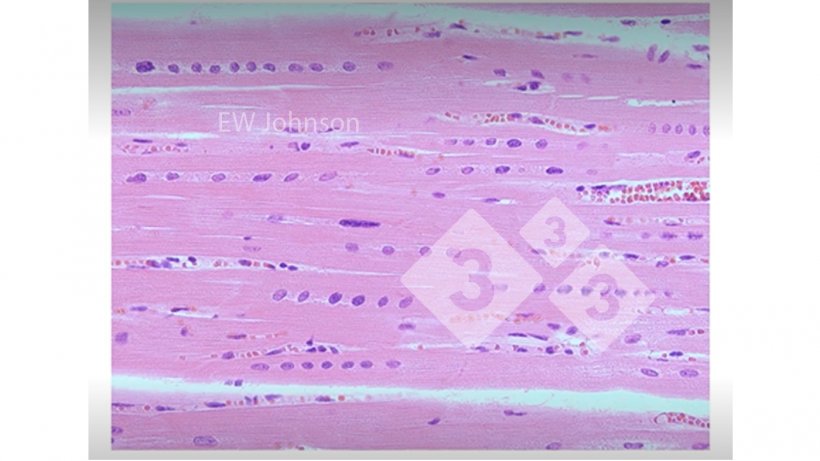 Figura 3. Muscolo cardiaco con emorragia, necrosi ialina e allineamento dei nuclei che mostrano carenza di vitamina E e selenio. Questi suini&nbsp;non avrebbero un sistema immunitario normalmente funzionante.
