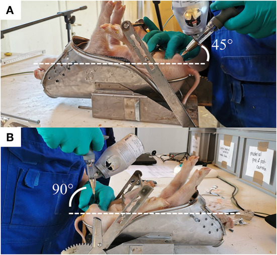 Figura 1 I due metodi di iniezione dell&#39;anestetico locale. (A) L&#39;angolo di inserimento dell&#39;ago &egrave; mostrato per i metodi intra-funicolare (IF) e (B) intra-testicolare (IT).
