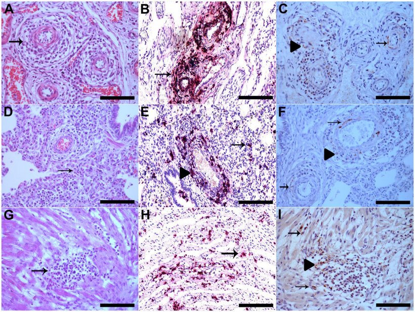 Figura 1. (A) Le pareti dei vasi del plesso mesenterico sono interrotte da una marcata infiltrazione di linfociti, istiociti e plasmacellule, oltre alla degenerazione fibrinoide (freccia), HE, Bar. 120 μm. (B) Plesso mesenterico vascolare con colorazione PCV3 nelle cellule infiammatorie e nelle pareti dei vasi che è mostrato in rosso (freccia), l'ematossilina è stata utilizzata come colorante di contrasto per tingere la sezione tissutale per ISH Bar. 120 μm. (C) Plesso mesenterico vascolare con immunomarcatura PCV3 nel citoplasma delle cellule infiammatorie nelle aree perivascolari (punta di freccia) e nel citoplasma e nel nucleo delle cellule della muscolatura liscia delle arterie (freccia), IHQ, AEC, Bar. 120 μm. (D) Polmone con setti alveolari diffusamente dilatati da linfociti e macrofagi (polmonite interstiziale) (freccia), HE, Bar. 120 μm. (E) Polmone con colorazione multifocale di PCV3 nelle cellule infiammatorie nelle aree interstiziali (freccia) e nelle aree perivascolari, che è mostrato in rosso (punta di freccia), ISH, Bar. 120 μm. (F) Polmone con immunomarcatura PCV3 nel citoplasma delle cellule infiammatorie nelle aree perivascolari (punta di freccia) e nel citoplasma e nel nucleo delle cellule della muscolatura liscia delle arterie (freccia), IHQ, AEC, Bar. 120 μm. (G) area di lieve miocardite linfoistiocitica (freccia), HE, Bar. 120 μm. (H) Cardiomiociti con colorazione PCV3 multifocale, mostrata in rosso (freccia), ISH, Bar. 120 μm. (I) Cuore con immunomarcatura PCV3 nel citoplasma delle cellule infiammatorie (punta di freccia) e nel citoplasma dei cardiomiociti (freccia), IHQ, AEC, Bar. 120 μm.
Ulteriori informazioni su questo testo di originePer avere ulteriori informazioni sulla traduzione è necessario il testo di origine
Invia commenti
Riquadri laterali