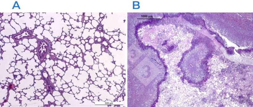 Figura 2. Colorazione ematossilina-eosina in un polmone normale (A) e malato&nbsp;(B). Il polmone B &egrave; affetto da una pleuropolmonite fibrino-necrotizzante causata da Actinobacillus pleuropneumoniae.
