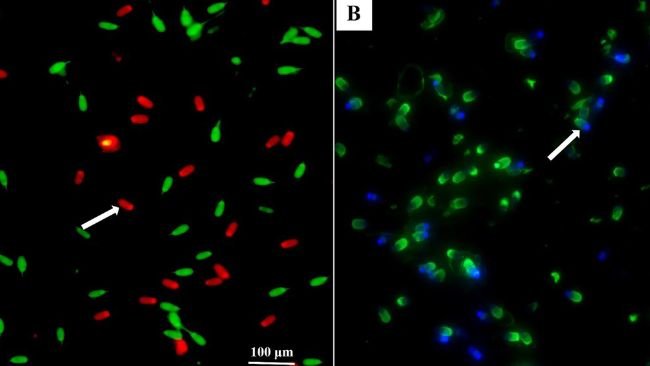 Figura 1. Microfotografie degli spermatozoi post-scongelati colorati con membrana utilizzando SYBR-14/PI e isotiocianato di fluoresceina acrosomiale-agglutinina di arachidi (FITC-PNA). Immagini (A, B) ottenute al microscopio a contrasto di fase. Nell'immagine (A), la freccia blu indicava l'integrità della membrana e la freccia bianca indicava la membrana danneggiata. Nell'immagine (B), la freccia blu indicava acrosomi intatti e spermatozoi con fluorescenza intensa della capsula acrosomiale, indicata da una membrana acrosomiale esterna intatta. La freccia bianca indicava acrosomi danneggiati e spermatozoi con fluorescenza blu, che indicava una perdita della membrana acrosomiale esterna (barre = 100 μm). Fonte: Front. Vet. Sci. 12:1573983. doi: 10.3389/fvets.2025.1573983