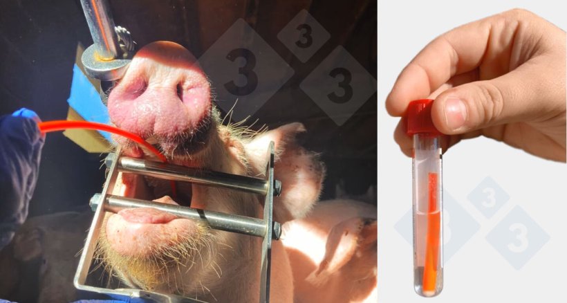 Raccolta di campioni di raschiamento tracheobronchiale.
