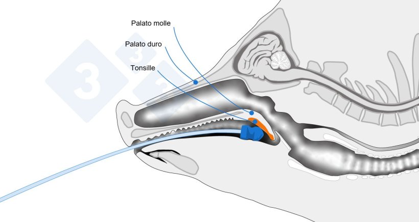 Schema anatomico che indica il punto di campionamento.
