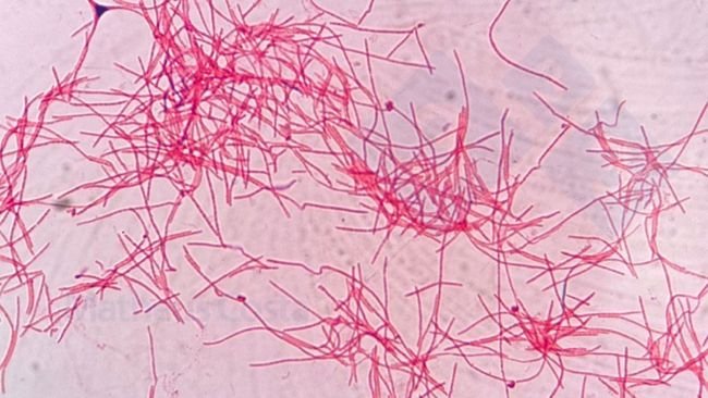 Figura 2. Fusobacterium necrophorum al microscopio.
