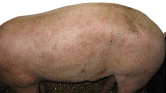 Forma cutánea o urticante de la erisipela porcina.