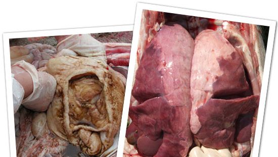 Polmonite e ulcere gastriche
