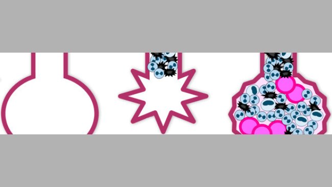 Patogenese del virusl dell'Influenza Suina