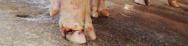 Lesioni agli unghielli in un caso di malattia vescicolare idiopatica