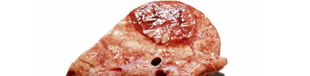 Sezione di una lesione similare