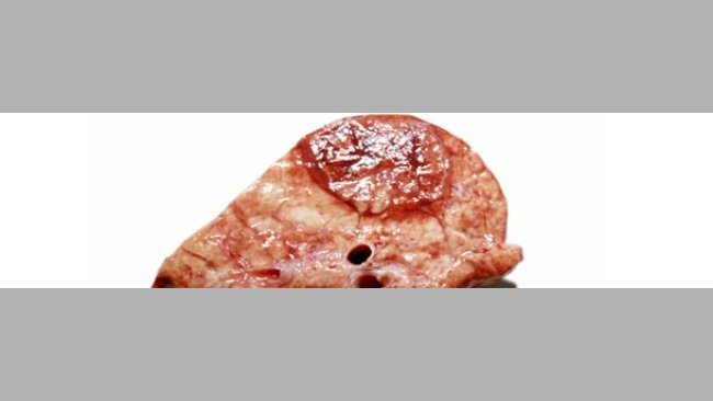 Sezione di una lesione similare