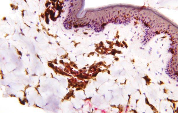 Distribuzione delle cellule dendritiche sull&#39;epidermide, derma e tessuto sottocutaneo nel suino.
