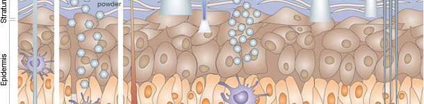 Immunizzazione per via cutanea

