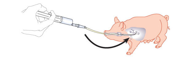 Figura 1. Schema di lavaggio broncoalveolare e raschiatura bronchiale
