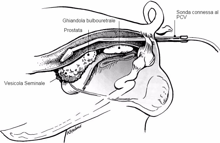 Figura 1:Posizionamento del supporto della sonda attraverso il retto per la visualizzazione delle ghiandole sessuali accessorie del verro&nbsp;(Clark &amp; ​​Althouse, 2002).&nbsp;
