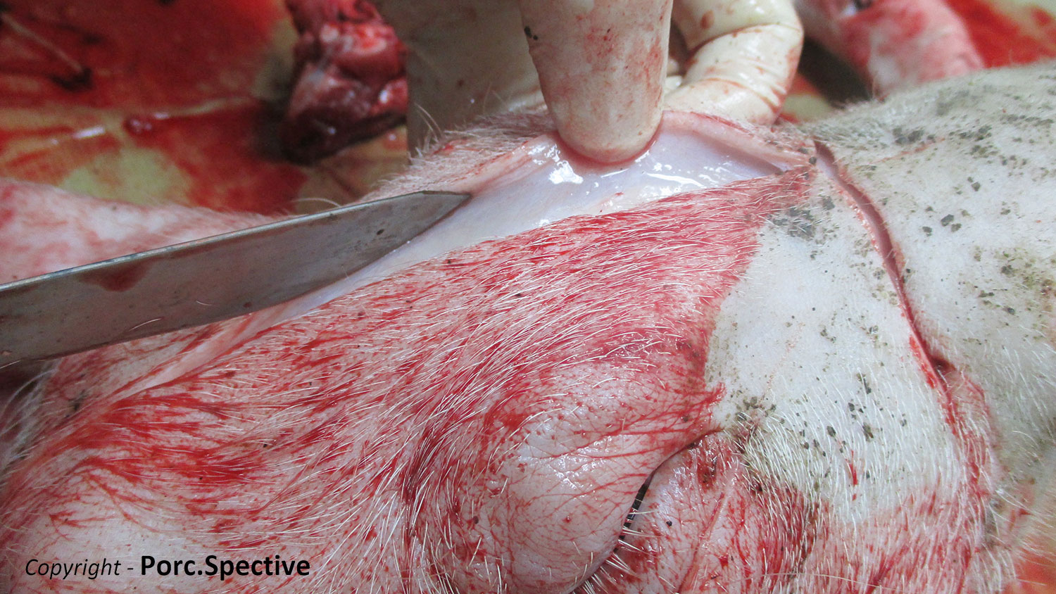 Foto 1. Edema sottocutaneo al viso
