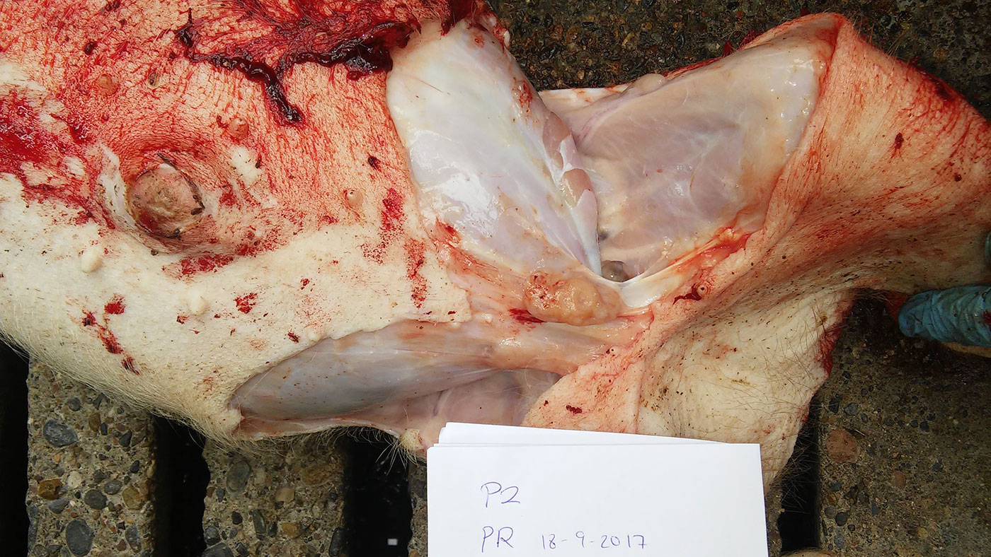 Linfonodo mesenterico aumentato di dimensione