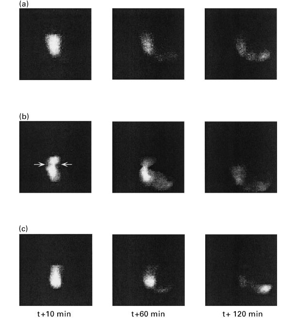 Figura 1. Immagini di svuotamento gastrico nei suini alimentati con una dieta a base di amido (a), polpa di barbabietola (b) e crusca di frumento a 10, 60 e 120 minuti dopo l&#39;ingestione (Fonte: Guerin et al., 2001 ).
