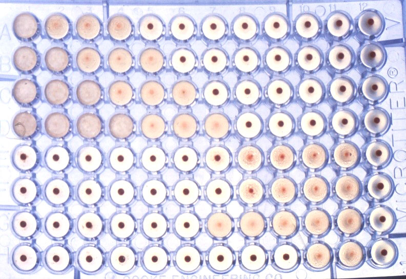 Figura 3: Test dell&#39;emoagglutinazione per il rilevamento degli anticorpi&nbsp;anti-Brucella nel siero.
